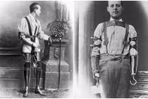 Xem ảnh thật những bộ chân tay giả từ thế kỷ 19