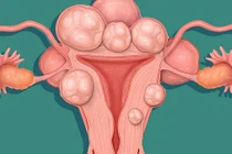 Tưởng bầu 7 tháng, cô gái khổ tâm vì thứ kẹt cứng trong bụng