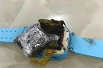 Bé gái bỏng nặng vì món đồ nhiều đứa trẻ ao ước