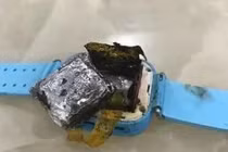 Bé gái bỏng nặng vì món đồ nhiều đứa trẻ ao ước