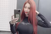 Phản cảm mốt quần thun siêu ngắn “đốt cháy” phố phường