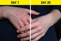 Mẹo dưỡng da tay thô ráp trở nên mềm mượt từng centimet