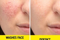 Hậu quả rửa mặt khi tắm, dưỡng da cầu kì đến mấy cũng vô ích
