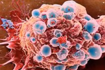 Đột phá mới nhất trong điều trị ung thư vú 