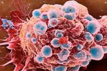 Đột phá mới nhất trong điều trị ung thư vú 