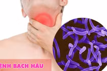 1 người chết, 3 người dương tính, 31 trường hợp theo dõi bệnh bạch hầu