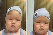 Phát sốt với em bé bị cháy nắng, in hình khẩu trang trên mặt