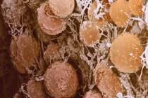 Vạn vật đời thường trở nên kinh dị qua lăng kính hiển vi