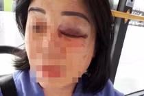 Công an vào cuộc vụ nhân viên xe buýt ở TP.HCM bị tấn công