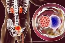 Top 10 bệnh lây truyền qua đường tình dục