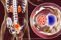 Top 10 bệnh lây truyền qua đường tình dục