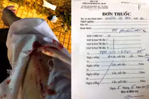 Bị 2 kẻ đi xe máy tấn công, cô gái phải tiêm thuốc phơi nhiễm HIV