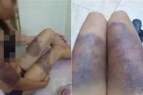 Thu giữ súng, dao... nơi nhóm hung thủ tra tấn thai phụ sẩy thai