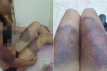 Thu giữ súng, dao... nơi nhóm hung thủ tra tấn thai phụ sẩy thai