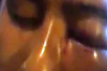 Cán bộ Ngân hàng Agribank “tự vệ”, nguyên chiến sĩ Công an suýt mù mắt