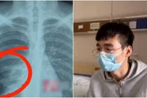 Video: Đam mê hát karaoke, sung quá hoá ra… nhập viện!