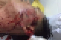 Bị phạt vi phạm giao thông, đập ly vào mặt đại úy công an trong quán nhậu