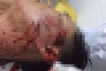 Bị phạt vi phạm giao thông, đập ly vào mặt đại úy công an trong quán nhậu