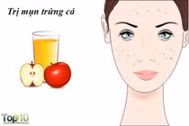 Lợi ích không ngờ của giấm táo với phụ nữ