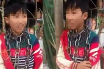 Video: Bé trai ở Thanh Hóa bị quấn vòng xích quanh cổ