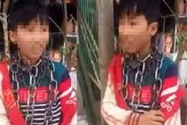 Video: Bé trai ở Thanh Hóa bị quấn vòng xích quanh cổ