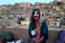 Bị ép nghe nhạc rap, bò nổi điên, lao vào húc vỡ mũi nữ du khách