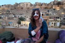 Bị ép nghe nhạc rap, bò nổi điên, lao vào húc vỡ mũi nữ du khách