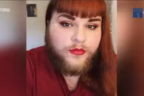 Video: Tình yêu đẹp như mơ của cô gái có râu quai nón như đàn ông