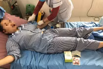 Bắc Kạn: Bé gái 14 tuổi nhập viện sau 6 ngày uống thuốc giảm cân