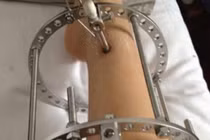 Những kiểu phẫu thuật thẩm mỹ nguy hiểm không nên áp dụng