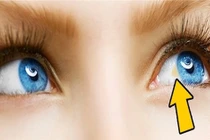 Dấu hiệu cảnh báo từ đôi mắt, phải khám ngay trước khi quá muộn