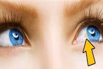 Dấu hiệu cảnh báo từ đôi mắt, phải khám ngay trước khi quá muộn