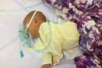 Lạng Sơn: Cắt rốn bằng kéo tại nhà, bé trai người Dao tử vong