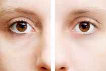 10 mẹo giúp bạn đẹp lên nhanh chóng chẳng tốn nhiều tiền