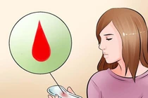 Dấu hiệu u xơ tử cung chị em nhất định phải nắm rõ