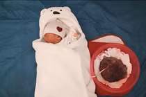 Tự đẻ tại nhà, bà mẹ không cắt rốn cho con, đặt con cạnh bánh nhau 6 ngày