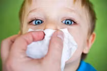 Bé 2 tuổi tử vong vì mẹ trẻ chữa máu cam sai cách