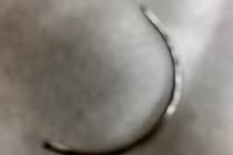 Bình Phước: Bác sĩ làm rơi kim khâu vào vùng kín, sản phụ chảy máu ồ ạt