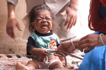 Kỳ lạ chàng trai 23 tuổi trong hình hài em bé 1 tuổi