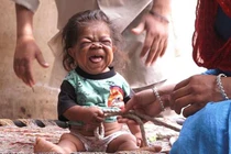 Kỳ lạ chàng trai 23 tuổi trong hình hài em bé 1 tuổi