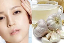 Cách trị mụn đầu đen siêu hiệu quả bằng tỏi