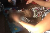 Nghi án bé gái 4 tuổi bị bạn của bố bạo hành đến tử vong