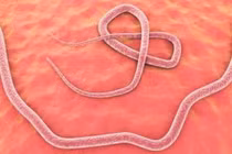 Hãi hùng 100 trứng sán dây trong não bé gái 8 tuổi