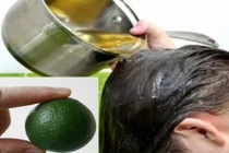 3 công thức làm sạch gàu nhanh chóng tại nhà