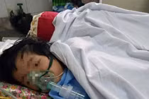 Quảng Ninh: Ngã trên lớp mầm non tư thục, bé 20 tháng tuổi rạn hộp sọ, liệt nửa người