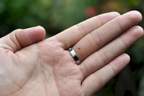 Phụ nữ có nốt ruồi ở ngón tay: Những điều cần nhớ