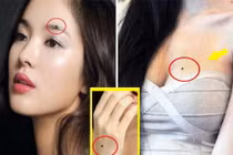 4 nốt ruồi lật ngược số mệnh của phụ nữ, chưa tới 40 đã là bà chủ