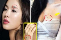 4 nốt ruồi lật ngược số mệnh của phụ nữ, chưa tới 40 đã là bà chủ