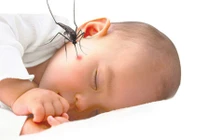 Trị côn trùng đốt cực hay cho bé bằng thực phẩm nhà bếp