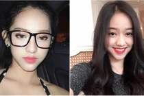 Hành trình dao kéo gian nan của bồ nhí Phan Thành